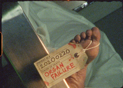 Toe Tag Organ Failure